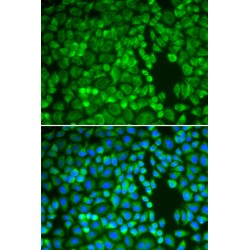 Insulin Degrading Enzyme (IDE) Antibody