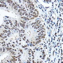 Paired Box Protein Pax-3 (PAX3) Antibody