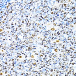 X-Ray Repair Cross-Complementing Protein 4 (XRCC4) Antibody