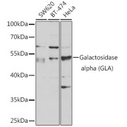 Western blot analysis of various lysates using Alpha-Galactosidase A (GLA) Antibody at 1/1000 dilution. Secondary antibody: HRP-conjugated Goat anti-Rabbit IgG (H+L) at 1/10000 dilution. Lysates/proteins: 25 µg per lane. Blocking buffer: 3% nonfat dry milk in TBST. Exposure time: 30s.