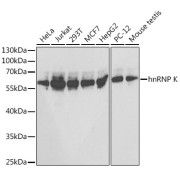 Western blot analysis of various lysates using hnRNP K Antibody at 1/1000 dilution. Secondary antibody: HRP-conjugated Goat anti-Rabbit IgG (H+L) at 1/10000 dilution. Lysates/proteins: 25 µg per lane. Blocking buffer: 3% nonfat dry milk in TBST.