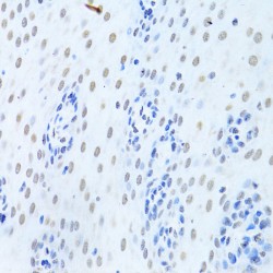 Heterogeneous Nuclear Ribonucleoprotein K (HNRNPK) Antibody