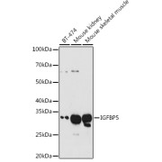 Western blot analysis of various lysates using IGFBP5 Antibody at 1/1000 dilution. Secondary antibody: HRP-conjugated Goat anti-Rabbit IgG (H+L) at 1/10000 dilution. Lysates/proteins: 25 µg per lane. Blocking buffer: 3% nonfat dry milk in TBST. Exposure time: 180s.