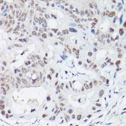DNA Ligase 4 (LIG4) Antibody