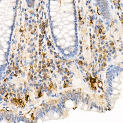 Ferritin Light Chain (FTL) Antibody