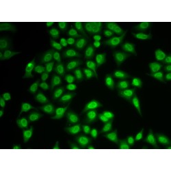 Proteasome Subunit Beta Type-9 (PSMB9) Antibody