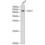 Western blot analysis of various lysates using SDC2 Antibody at 1/1000 dilution. Secondary antibody: HRP-conjugated Goat anti-Rabbit IgG (H+L) at 1/10000 dilution. Lysates / proteins: 25 µg per lane. Blocking buffer: 3 % nonfat dry milk in TBST. Detection: ECL Basic Kit (RM00020). Exposure time: 5s.