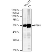 Western blot analysis of lysates from wild type (WT) and PTBP1 knockout (KO) HeLa cells, using [KO Validated] PTBP1 Antibody at 1/1000 dilution. Secondary antibody: HRP-conjugated Goat anti-Rabbit IgG (H+L) at 1/10000 dilution. Lysates/proteins: 25 µg per lane. Blocking buffer: 3% nonfat dry milk in TBST. Exposure time: 5s.