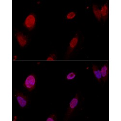 Polypyrimidine Tract-Binding Protein 1 (PTBP1) Antibody