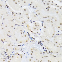 Polypyrimidine Tract-Binding Protein 1 (PTBP1) Antibody
