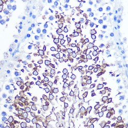 Leukocyte Surface Antigen CD47 (CD47) Antibody