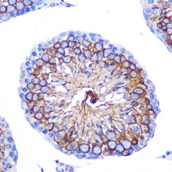 Leukocyte Surface Antigen CD47 (CD47) Antibody