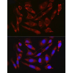 Leukocyte Surface Antigen CD47 (CD47) Antibody