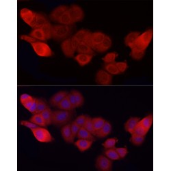 Leukocyte Surface Antigen CD47 (CD47) Antibody