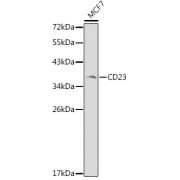 Western blot analysis of lysates from MCF-7 cells, using CD23 Antibody at 1/1000 dilution. Secondary antibody: HRP-conjugated Goat anti-Rabbit IgG (H+L) at 1/10000 dilution. Lysates/proteins: 25 µg per lane. Blocking buffer: 3% nonfat dry milk in TBST.