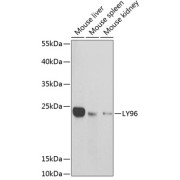 Western blot analysis of various lysates using LY96 Antibody at 1/1000 dilution. Secondary antibody: HRP-conjugated Goat anti-Rabbit IgG (H+L) at 1/10000 dilution. Lysates/proteins: 25 µg per lane. Blocking buffer: 3% nonfat dry milk in TBST.