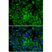 Western blot analysis of various lysates using ATG16L1 Antibody at 1/500 dilution. Secondary antibody: HRP-conjugated Goat anti-Rabbit IgG (H+L) at 1/10000 dilution. Lysates/proteins: 25 µg per lane. Blocking buffer: 3% nonfat dry milk in TBST. Exposure time: 180s.