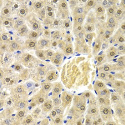 RAD9 Checkpoint Clamp Component A (RAD9A) Antibody