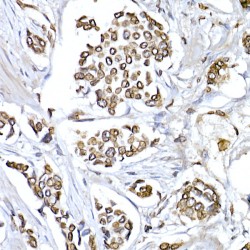 Lamin B1 (LMNB1) Antibody