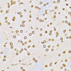 Lamin B1 (LMNB1) Antibody