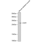 Western blot analysis of lysates from mouse muscle, using CNTF Antibody at 1/1000 dilution. Secondary antibody: HRP-conjugated Goat anti-Rabbit IgG (H+L) at 1/10000 dilution. Lysates/proteins: 25 µg per lane. Blocking buffer: 3% nonfat dry milk in TBST.