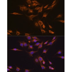 Ciliary Neurotrophic Factor (CNTF) Antibody