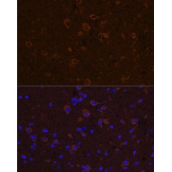 Ciliary Neurotrophic Factor (CNTF) Antibody