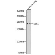 Western blot analysis of lysates from mouse lung, using DLC1 Antibody at 1/1000 dilution. Secondary antibody: HRP-conjugated Goat anti-Rabbit IgG (H+L) at 1/10000 dilution. Lysates/proteins: 25 µg per lane. Blocking buffer: 3% nonfat dry milk in TBST.
