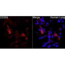 Macrophage Scavenger Receptor 1 (MSR1) Antibody