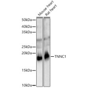 Western blot analysis of various lysates, using TNNC1 Antibody at 1/2000 dilution. Secondary antibody: HRP-conjugated Goat anti-Rabbit IgG (H+L) at 1/10000 dilution. Lysates/proteins: 25 µg per lane. Blocking buffer: 3% nonfat dry milk in TBST. Exposure time: 10s.