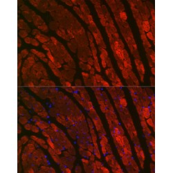 Troponin C, Slow Skeletal and Cardiac Muscles (TNNC1) Antibody