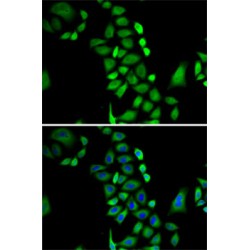 Glyoxalase I (GLO1) Antibody