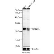 Western blot analysis of lysates from wild type(WT) and RAB27A knockdown (KD) U-87MG cells, using [KD Validated] RAB27A Antibody at 1/1000 dilution. Secondary antibody: HRP-conjugated Goat anti-Rabbit IgG (H+L) at 1/10000 dilution. Lysates/proteins: 25 µg per lane. Blocking buffer: 3% nonfat dry milk in TBST. Exposure time: 10s.