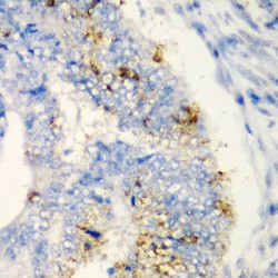 Toll/interleukin-1 Receptor Domain-Containing Adapter Protein (TIRAP) Antibody