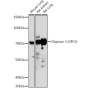 Western blot analysis of lysates from HepG2 cells, using Glypican 3 (Glypican 3 (GPC3)) Antibody at 1/1000 dilution. Secondary antibody: HRP-conjugated Goat anti-Rabbit IgG (H+L) at 1/10000 dilution. Lysates/proteins: 25 µg per lane. Blocking buffer: 3% nonfat dry milk in TBST. Exposure time: 3min.