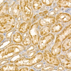 E3 Ubiquitin-Protein Ligase TRIM21 (TRIM21) Antibody