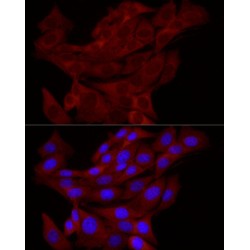 E3 Ubiquitin-Protein Ligase TRIM21 (TRIM21) Antibody