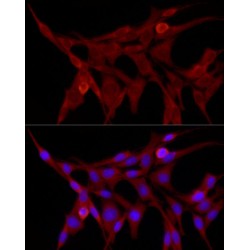 E3 Ubiquitin-Protein Ligase TRIM21 (TRIM21) Antibody