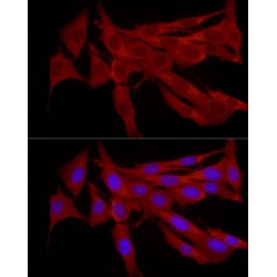 E3 Ubiquitin-Protein Ligase TRIM21 (TRIM21) Antibody