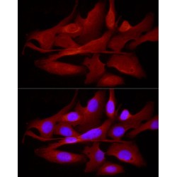 E3 Ubiquitin-Protein Ligase TRIM21 (TRIM21) Antibody