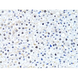 Histone H2B Type 2-E (HIST2H2BE) Antibody