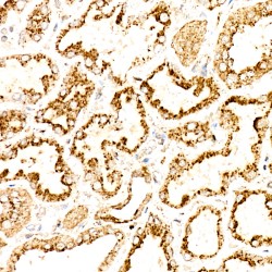 Lysosomal Associated Membrane Protein 2 (LAMP2) Antibody