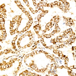 Lysosomal Associated Membrane Protein 2 (LAMP2) Antibody