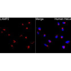Lysosomal Associated Membrane Protein 2 (LAMP2) Antibody