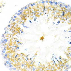 Tapasin (TAPBP) Antibody