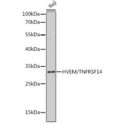 abx001604
