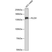 Western blot analysis of lysates from HeLa cells using PLCB1 Antibody at 1/500 dilution. Secondary antibody: HRP-conjugated Goat anti-Rabbit IgG (H+L) at 1/10000 dilution. Lysates/proteins: 25 µg per lane. Blocking buffer: 3% nonfat dry milk in TBST. Exposure time: 60s.