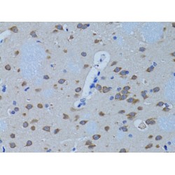 Phospholipase C Beta 1 (PLCB1) Antibody