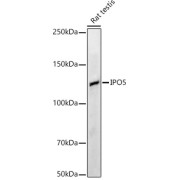 Western blot analysis of lysates from HeLa cells using IPO5 Antibody at 1/1000 dilution. Secondary antibody: HRP-conjugated Goat anti-Rabbit IgG (H+L) at 1/10000 dilution. Lysates/proteins: 25 µg per lane. Blocking buffer: 3% nonfat dry milk in TBST. Exposure time:30s.