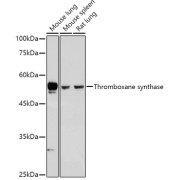 Western blot analysis of various lysates using Thromboxane synthase Antibody at 1/500 dilution. Secondary antibody: HRP-conjugated Goat anti-Rabbit IgG (H+L) at 1/10000 dilution. Lysates/proteins: 25 µg per lane. Blocking buffer: 3% nonfat dry milk in TBST. Exposure time: 5s.
